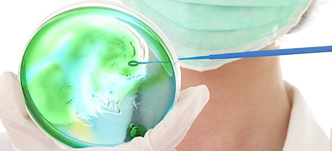 Cáncer de Cuello Uterino 