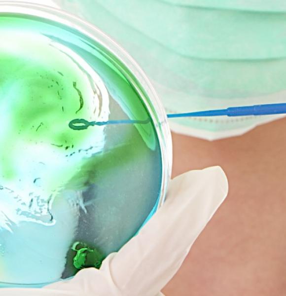 Cáncer de Cuello Uterino  mobile