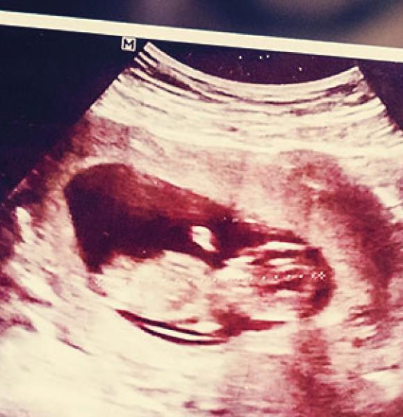 Programa de Control para la Gestante y su familia mobile